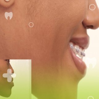 دلایل به وجود آمدن ناهنجاری آندربایت